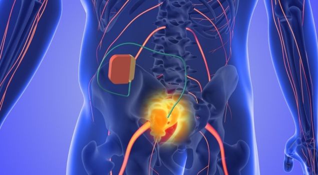 Μεσοπλεύρια νευραλγία