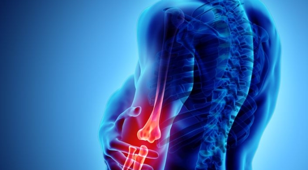 Επικονδυλίτιδα