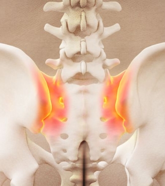 Πόνος ιερολαγόνιου άρθρωσης