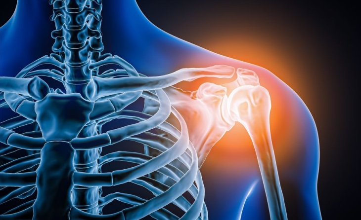 Παθήσεις ώμου