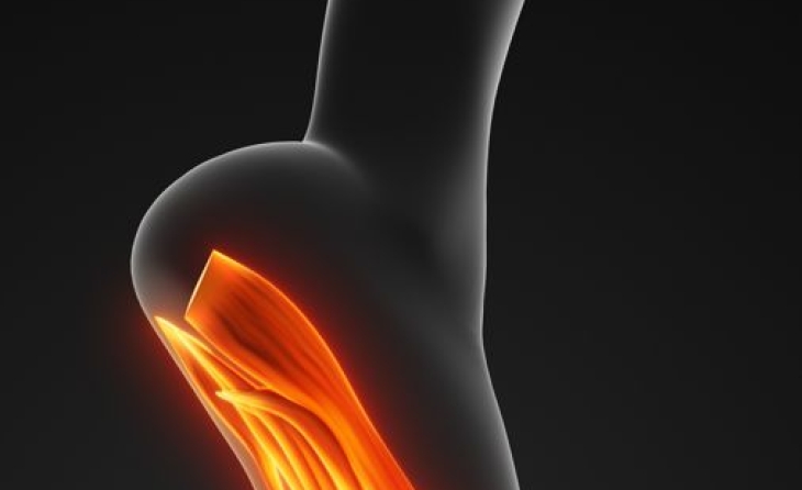 Πελματιαία απονευρωσίτιδα