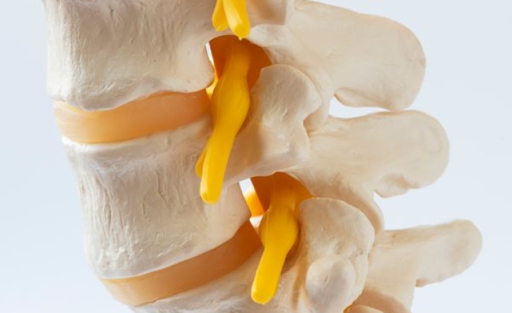 Κατάλυση ενδοσπονδυλικών νεύρων, Intracept procedure