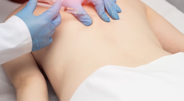 Αποκλεισμός μεσοπλεύριων νεύρων