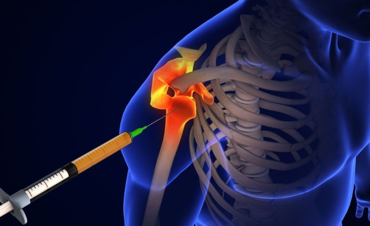 Τεχνική hydrodissection