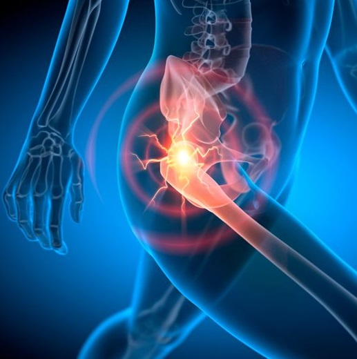 Πόνος ισχύου