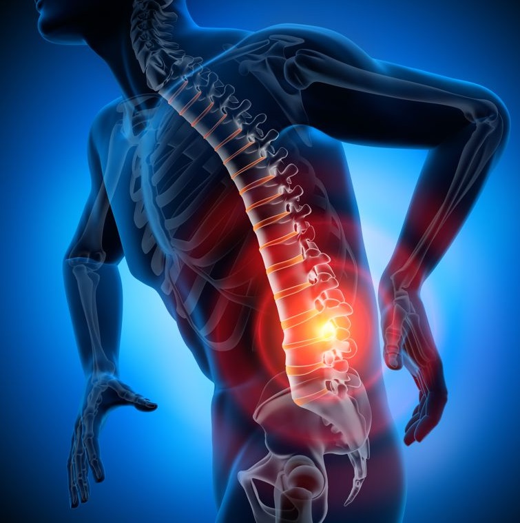 Οσφυαλγία και ισχιαλγία