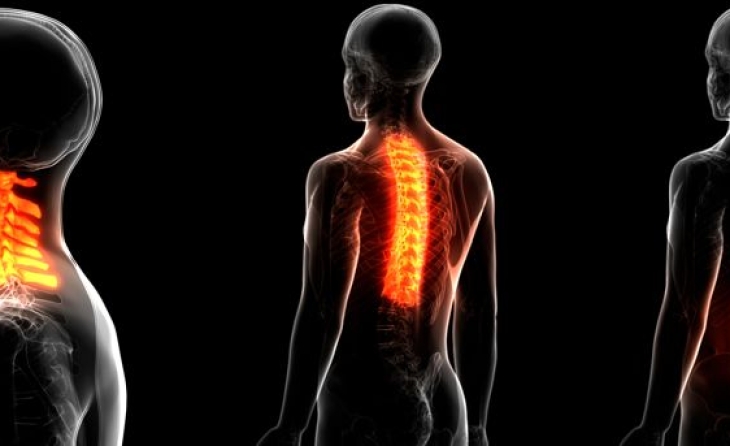 Σύνδρομο ζυγοαποφυσιακών αρθρώσεων