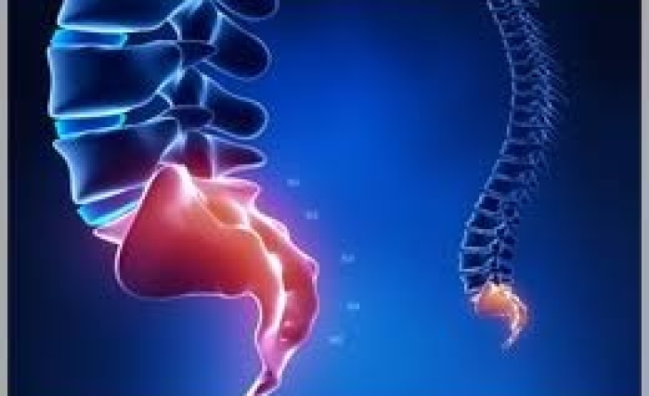 Κοκκυγοδυνία